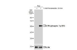 Lyn, p Tyr397 Antibody (HL122), Novus Biologicals 100 &mu;g | Buy Online | Novus Biologicals | Fisher Scientific