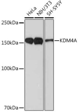 Lysine (K)-specific Demethylase 4A/KDM4A/JMJD2A Rabbit anti-Human, Mouse,