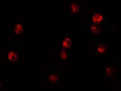 Lysine (K)-specific Demethylase 6B/KDM6B/JMJD3 Antibody - BSA Free, Novus
