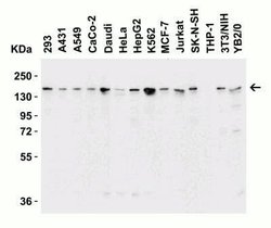 Lysine (K)-specific Demethylase 6B/KDM6B/JMJD3 Antibody - BSA Free, Novus