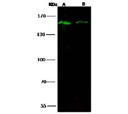Lysine (K)-specific Demethylase 3A/KDM3A/JMJD1A Antibody, Novus Biologicals