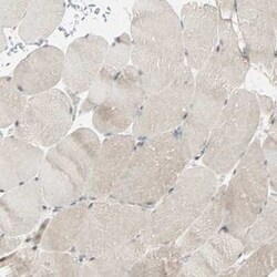 Lysine (K)-specific Demethylase 4A/KDM4A/JMJD2A Antibody, Novus Biologicals 0.1 mL | Buy Online | Novus Biologicals | Fisher Scientific