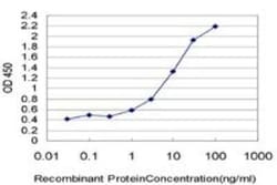 Lysine (K)-specific Demethylase 5B/KDM5B/JARID1B Antibody (1G10), Novus