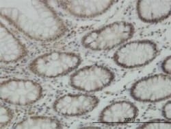 Lysine (K)-specific Demethylase 5B/KDM5B/JARID1B Antibody (1G10), Novus