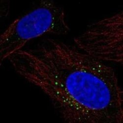 Lysosomal Pro-X Carboxypeptidase/PRCP Rabbit anti-Human, Polyclonal, Novus