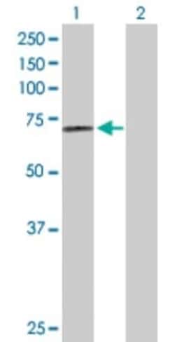 Lysosomal Pro-X Carboxypeptidase/PRCP Antibody, Novus Biologicals 0.1 mg | Buy Online | Novus Biologicals | Fisher Scientific