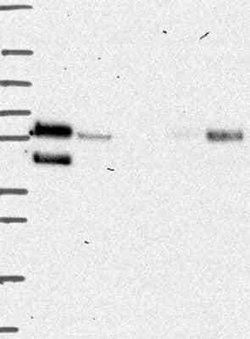 Lysosomal Pro-X Carboxypeptidase/PRCP Rabbit anti-Human, Polyclonal, Novus