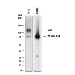 Human Lysosomal alpha-Glucosidase Antibody, R D Systems 100 &mu;g; Unconjugated:Antibodies,