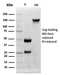 Lysozyme Antibody (LYZ/3942) - Azide and BSA Free, Novus Biologicals 100 &mu;g | Buy Online | Novus Biologicals | Fisher Scientific