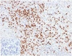 Lysozyme Mouse anti-Human, Clone: LYZ/3944, Novus Biologicals:Antibodies:Primary
