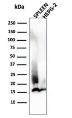 Lysozyme Mouse anti-Human, Clone: LYZ/3944, Novus Biologicals:Antibodies:Primary