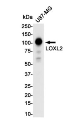Lysyl Oxidase Homolog 2/LOXL2 Antibody (S09-7J5), Novus Biologicals 100