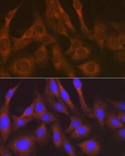 Lysyl tRNA synthetase Rabbit anti-Human, Mouse, Rat, Clone: 2V2B6, Novus