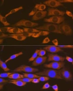 Lysyl tRNA synthetase Rabbit anti-Human, Mouse, Rat, Clone: 2V2B6, Novus