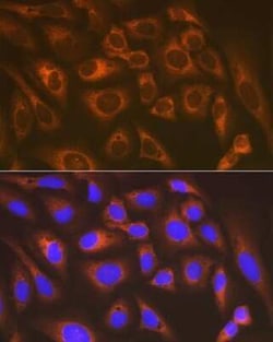 Lysyl tRNA synthetase Rabbit anti-Human, Mouse, Rat, Clone: 2V2B6, Novus
