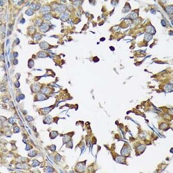 Lysyl tRNA synthetase Rabbit anti-Human, Mouse, Rat, Clone: 2V2B6, Novus