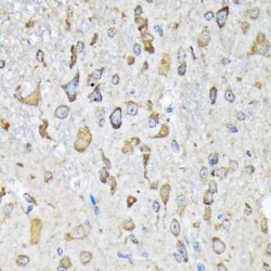Lysyl tRNA synthetase Rabbit anti-Human, Mouse, Rat, Clone: 2V2B6, Novus