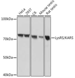 Lysyl tRNA synthetase Rabbit anti-Human, Mouse, Rat, Clone: 2V2B6, Novus