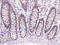 Lysyl tRNA synthetase Antibody, Novus Biologicals:Antibodies:Primary Antibodies