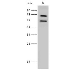 Lysyl tRNA synthetase Antibody, Novus Biologicals:Antibodies:Primary Antibodies