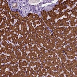 MACF1 Antibody, Novus Biologicals:Antibodies:Primary Antibodies