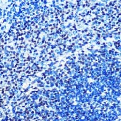MAD2L1 Rabbit anti-Human, Mouse, Rat, Clone: 5W5U1, Novus Biologicals:Antibodies:Primary