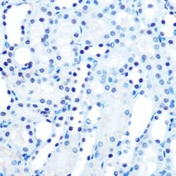 MAD2L1 Rabbit anti-Human, Mouse, Rat, Clone: 5W5U1, Novus Biologicals:Antibodies:Primary