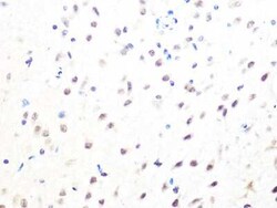 MAD2L2 Rabbit anti-Human, Mouse, Rat, Clone: 7B6I2, Novus Biologicals 100 &mu;g | Buy Online | Bio-Techne | Fisher Scientific