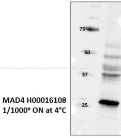 MAD4 Antibody, Novus Biologicals 50 &mu;g | Buy Online | Novus Biologicals | Fisher Scientific