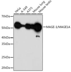 MAGE 1 Rabbit anti-Human, Mouse, Clone: 9Y6K1, Novus Biologicals:Antibodies:Primary