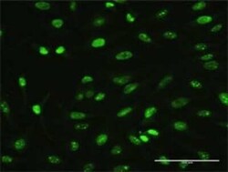 MAGEA2 Antibody (1B1), Novus Biologicals 0.1 mg | Buy Online | Novus Biologicals | Fisher Scientific