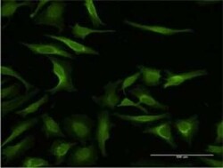 MAGEA3 Antibody (4D9), Novus Biologicals 0.1 mg | Buy Online | Novus Biologicals | Fisher Scientific