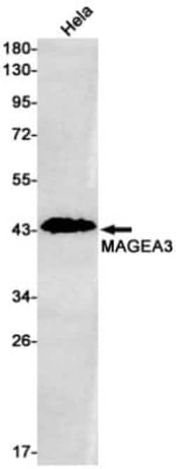 MAGEA3 Antibody (S07-8A2), Novus Biologicals:Antibodies:Primary Antibodies
