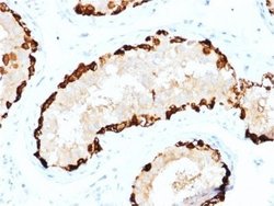 MAGEA4 Antibody (CPTC-MAGEA4-1) - Azide and BSA Free, Novus Biologicals