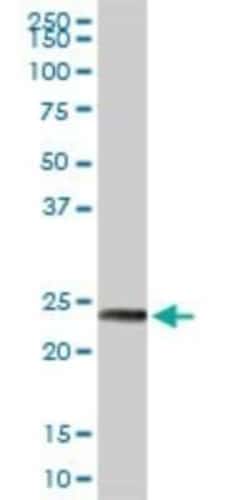 MAGEA8 Antibody, Novus Biologicals 0.1 mg | Buy Online | Novus Biologicals | Fisher Scientific