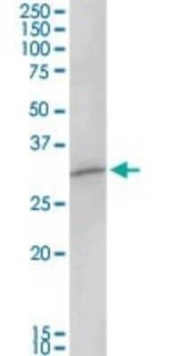 MAGEA8 Antibody, Novus Biologicals 0.1 mg | Buy Online | Novus Biologicals | Fisher Scientific