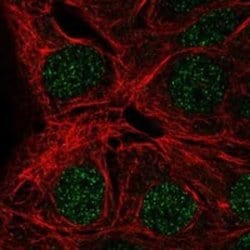 MAGEA9 Rabbit anti-Human, Polyclonal, Novus Biologicals 100 &mu;g | Buy Online | Novus Biologicals | Fisher Scientific