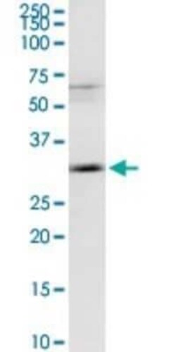 MAGEA9 Antibody, Novus Biologicals 0.1 mg | Buy Online | Novus Biologicals | Fisher Scientific