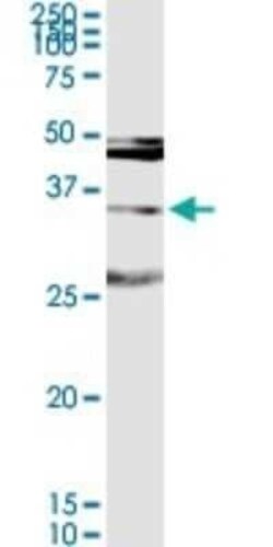 MAGEA9 Antibody, Novus Biologicals 0.1 mg | Buy Online | Novus Biologicals | Fisher Scientific
