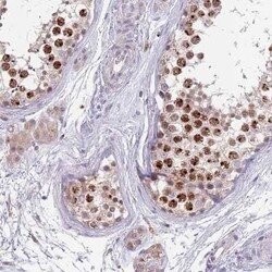 MAGEB18 Antibody, Novus Biologicals 0.1 mL | Buy Online | Novus Biologicals | Fisher Scientific