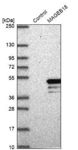 MAGEB18 Antibody, Novus Biologicals 0.1 mL | Buy Online | Novus Biologicals | Fisher Scientific
