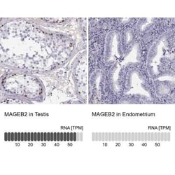 MAGEB2 Antibody, Novus Biologicals 25ul; Unconjugated:Antibodies, Polyclonal