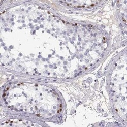 MAGEB2 Antibody, Novus Biologicals 25ul; Unconjugated:Antibodies, Polyclonal