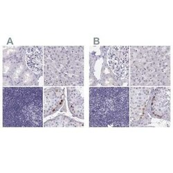 MAGEB2 Antibody, Novus Biologicals 25ul; Unconjugated:Antibodies, Polyclonal