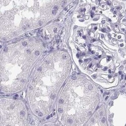 MAGEB2 Antibody, Novus Biologicals 25ul; Unconjugated:Antibodies, Polyclonal