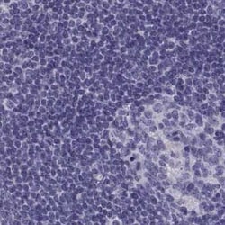 MAGEB2 Antibody, Novus Biologicals 25ul; Unconjugated:Antibodies, Polyclonal