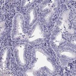 MAGEB2 Antibody, Novus Biologicals:Antibodies:Primary Antibodies
