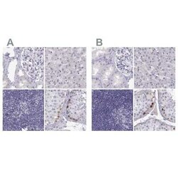 MAGEB2 Antibody, Novus Biologicals:Antibodies:Primary Antibodies