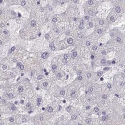 MAGEB2 Antibody, Novus Biologicals:Antibodies:Primary Antibodies