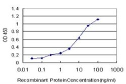MAGI1 Antibody (7B4), Novus Biologicals 0.1 mg | Buy Online | Novus Biologicals | Fisher Scientific